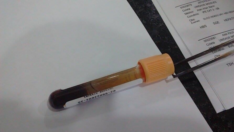 Aids ainda é uma grande preocupação em São Borja
